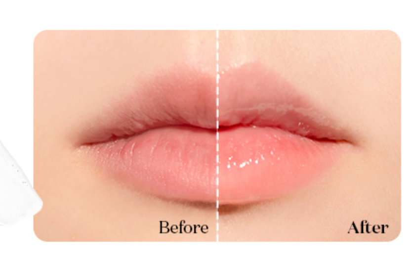 VT Reedle Shot Lip Plumper Expert